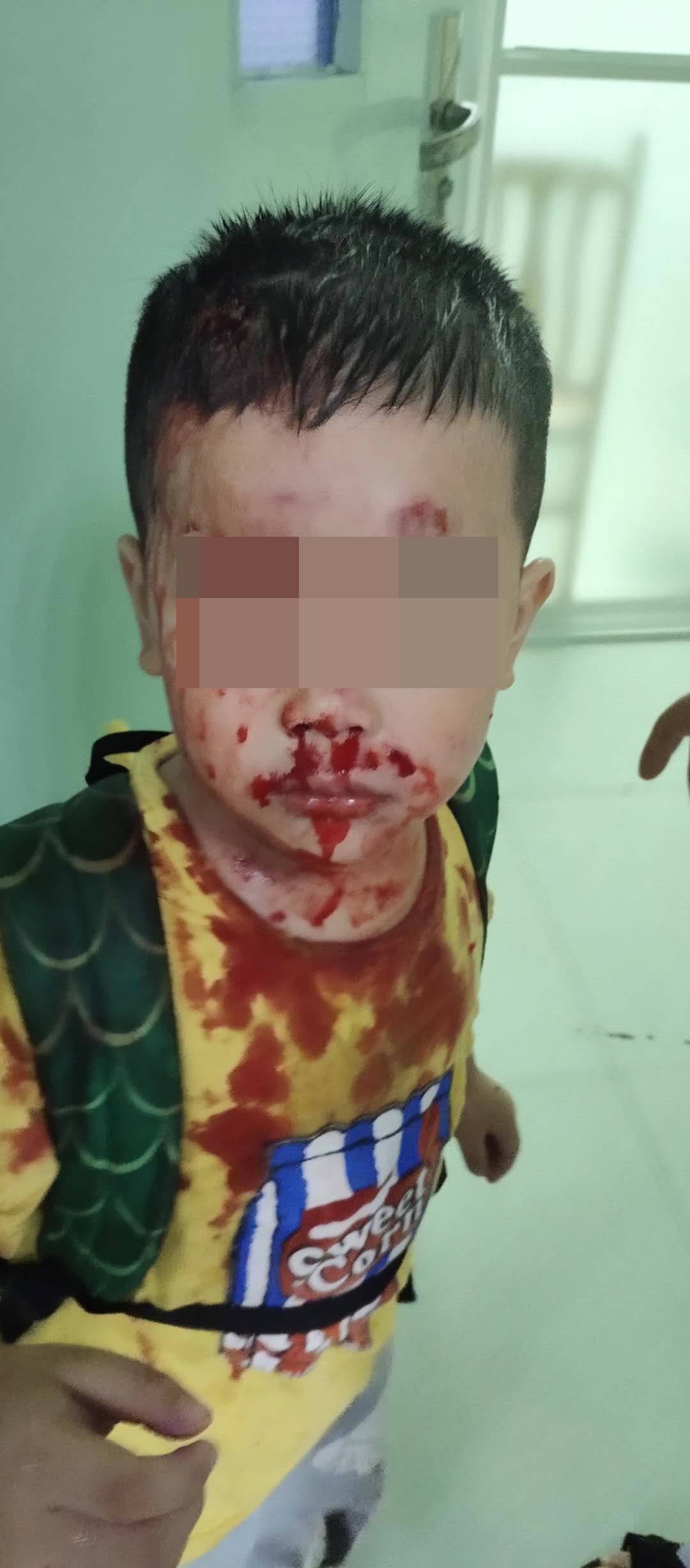 罗奇代尔车祸：一名妇女在汽车撞向行人后死亡，其中包括一名儿童受伤