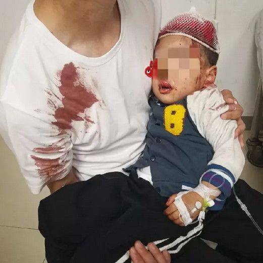 罗奇代尔车祸：一名妇女在汽车撞向行人后死亡，其中包括一名儿童受伤